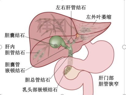 图片13.png 图片13.png