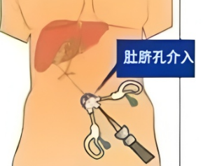 图片14.png 图片14.png